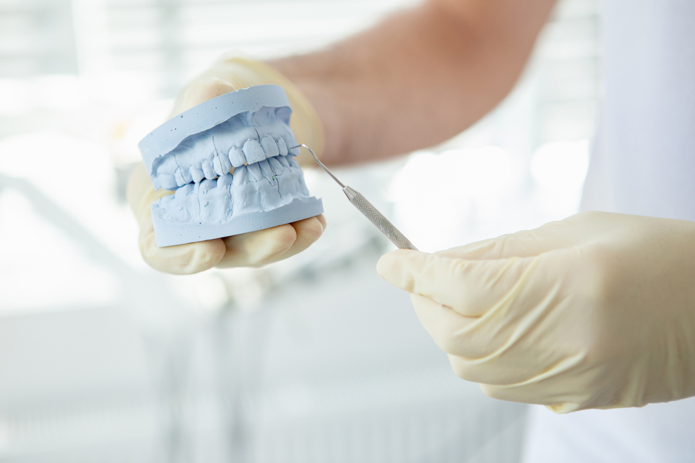 Dentist holding a teeth model - University Place Cosmetic Dentistry