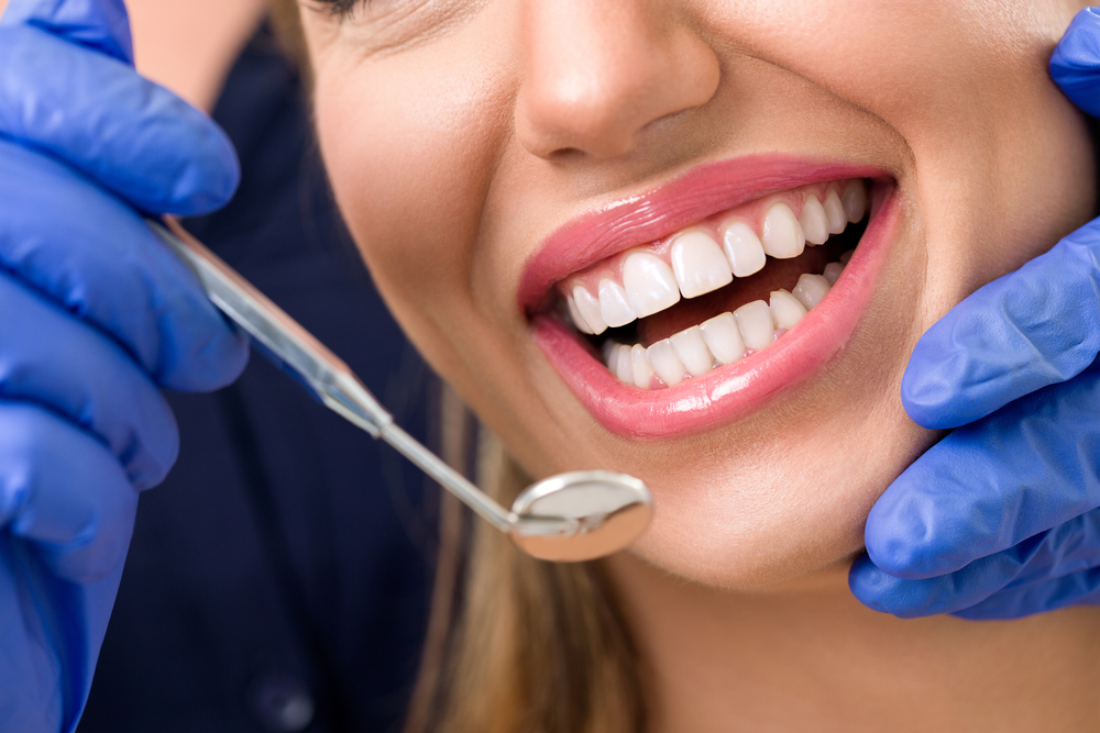 Woman with perfect teeth having a dental check up - University Place Cosmetic Dentistry